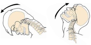 むち打ちの画像